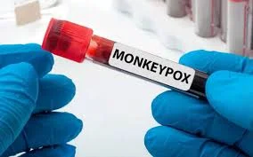 پاکستان منکی پاکس کیس رپورٹ، صحت محکمے نے تصدیق کردی